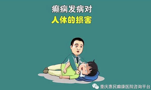 重庆那家医院治癫痫_癫痫青少年发作有哪些症状?