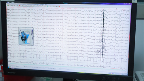四川癫痫病治疗最好的医院_癫痫发作但脑电图正常，背后的医学之谜？