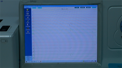 重庆做24小时脑电图多少钱_光敏性癫痫有哪些特点？