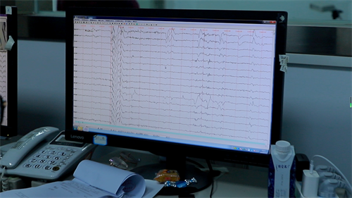 重庆脑电图检查要多少钱_父母该如何做才能帮助孩子治疗癫痫？
